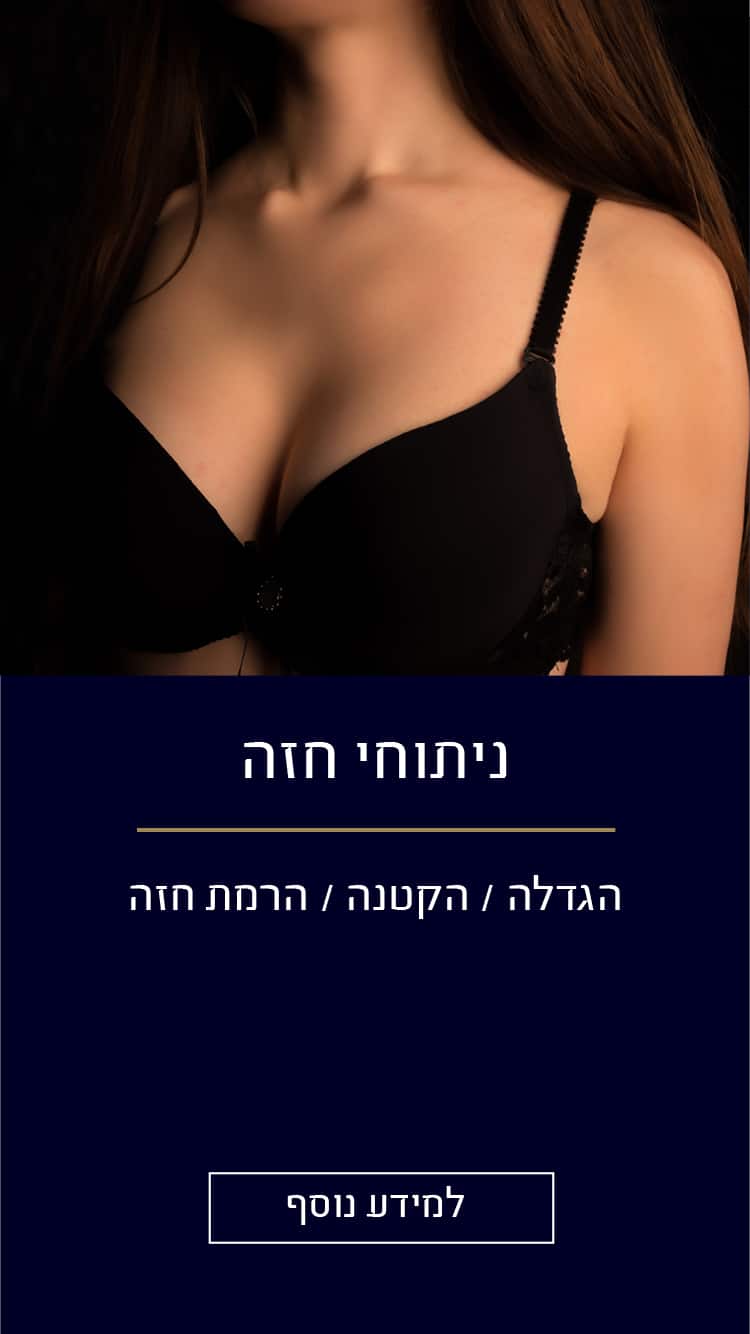 ניתוחי חזה